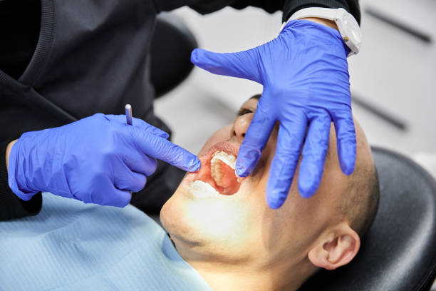 Best Emergency Tooth Extraction in Malvern, IA